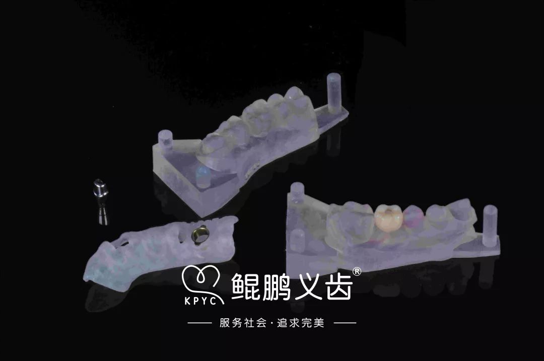 數(shù)字化種植導(dǎo)板 